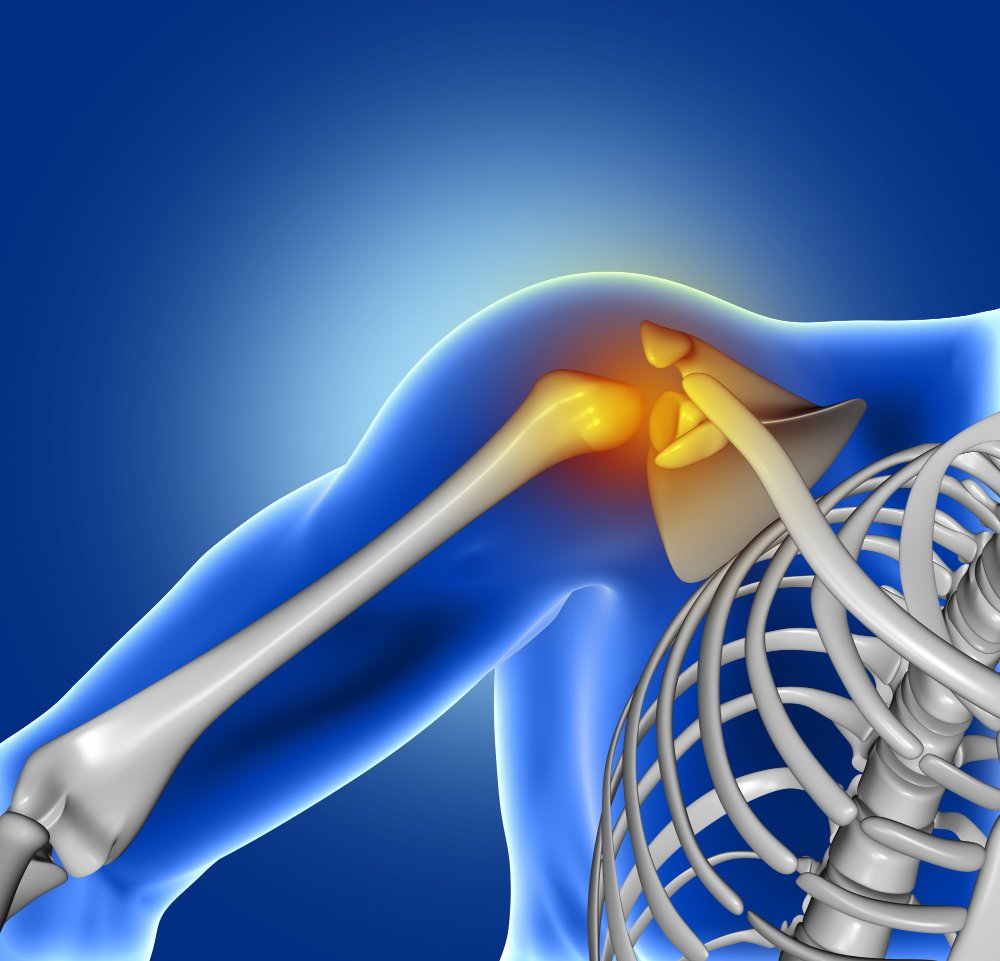 Desgaste articular