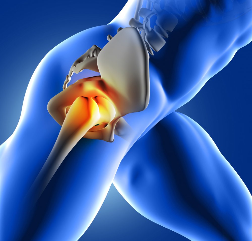 Prótesis de cadera y rodilla